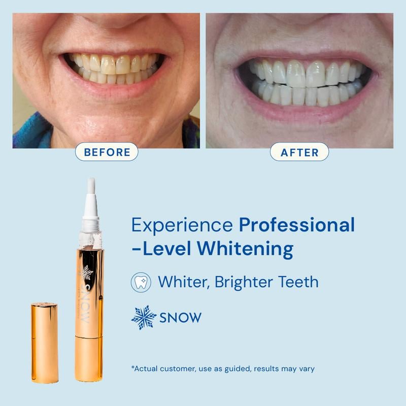⏰Limited Time Promotion 49% Off⚡Whitening Pen for Stain Removal & Whiter Teeth