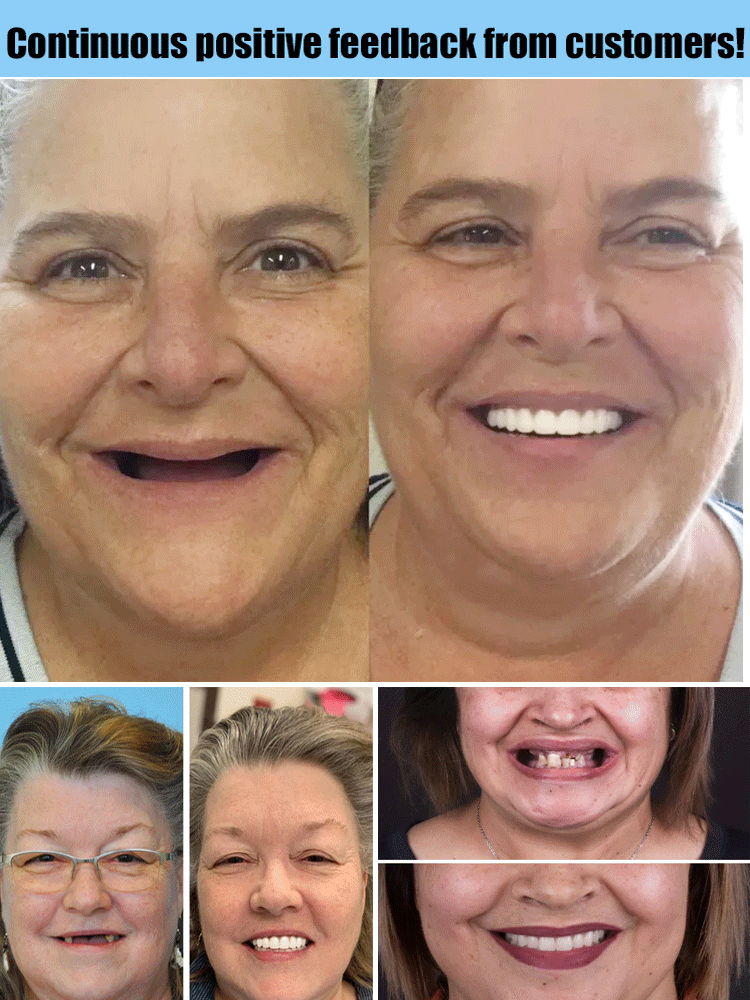 🦷Advanced Customized Full Denture Set🦷  (🔥10,000+ Sold In Last 30 Day)